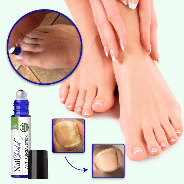 Nailshield® Say goodbye to nail fungus